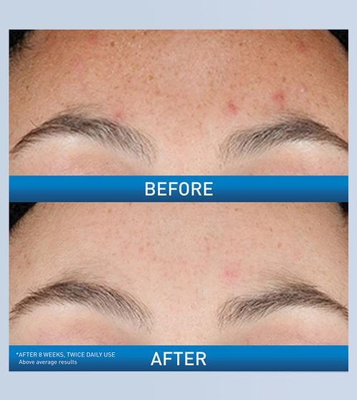 CeraVe Resurfacing Retinol Serum